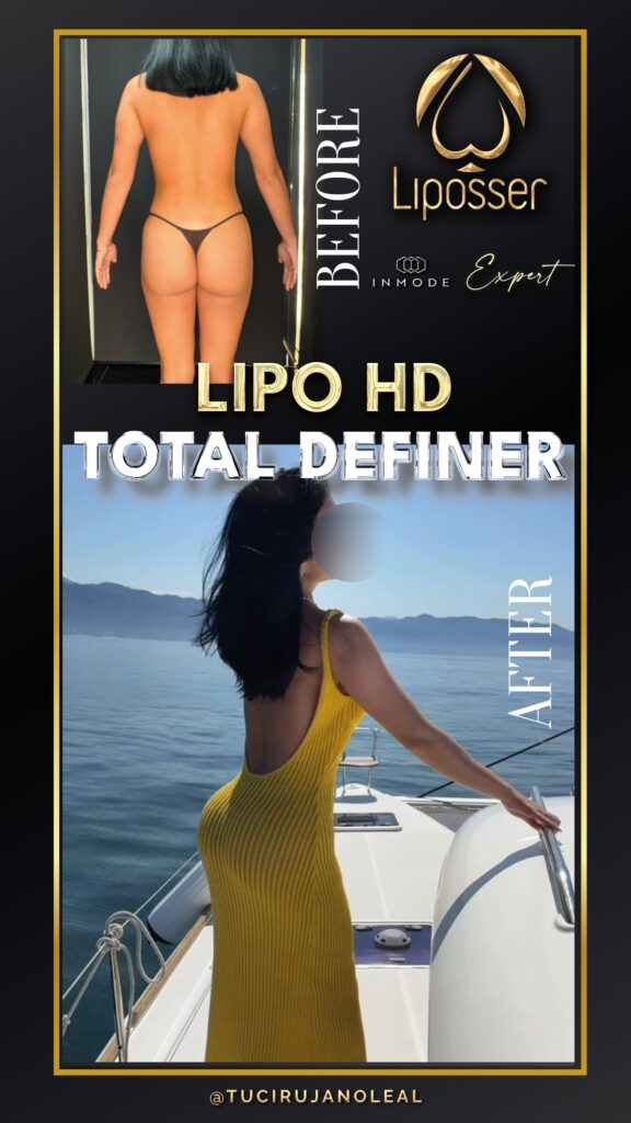 LIipoHD_totaldefiner