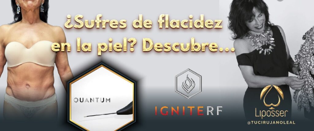 liposser-flacides-001