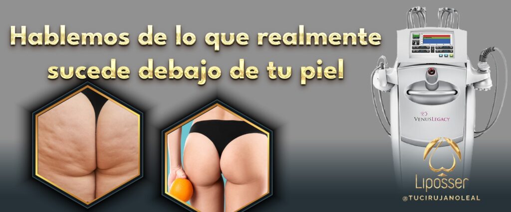 liposser-blog-debajo-de-la-piel