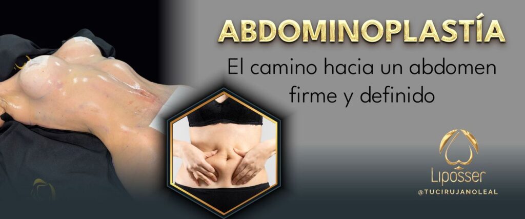 liposser-bdominoplastia-001
